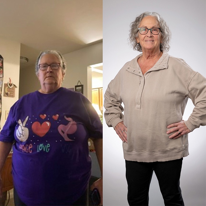 Deborah Jobe before and after