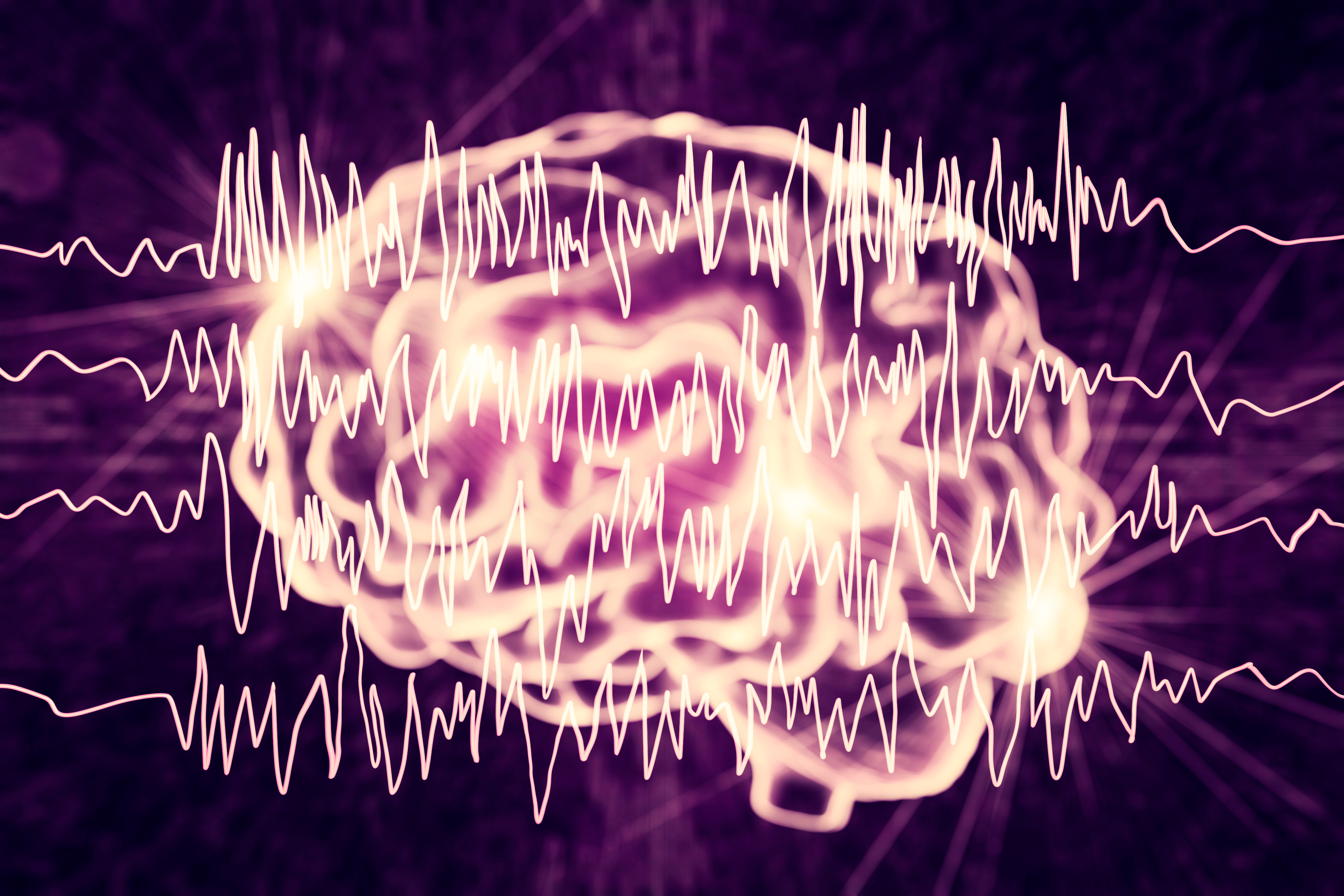 Abstract brain with EMG waves 