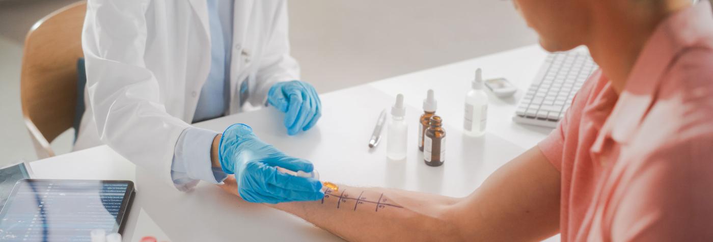 Allergy testing on arm of male patient