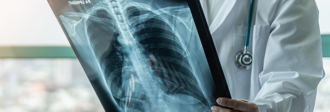 Healthcare provider holds up chest X-Ray